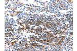 The image on the left is immunohistochemistry of paraffin-embedded Human tonsil tissue using CSB-PA553249(GJB6 Antibody) at dilution 1/40, on the right is treated with synthetic peptide. (Original magnification: 