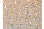 The image on the left is immunohistochemistry of paraffin-embedded Human brain tissue using CSB-PA554629(AURKC Antibody) at dilution 1/15, on the right is treated with synthetic peptide. (Original magnification: 