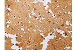 The image on the left is immunohistochemistry of paraffin-embedded Human brain tissue using CSB-PA555140(ATG4C Antibody) at dilution 1/20, on the right is treated with fusion protein. (Original magnification: 