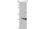 Gel: 8%SDS-PAGE, Lysate: 1,5,10,20 &mu;g, Lane: GFP transfected 293T cells, Primary antibody: CSB-PA557657(GFP Antibody) at dilution 1/800, Secondary antibody: Goat anti rabbit IgG at 1/8000 dilution, Exposure time: 30 seconds