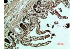Immunohistochemical analysis of paraffin-embedded human-colon, antibody was diluted at 1:200
