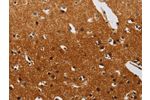 The image on the left is immunohistochemistry of paraffin-embedded Human brain tissue using CSB-PA559099(DTNBP1 Antibody) at dilution 1/20, on the right is treated with synthetic peptide. (Original magnification: 