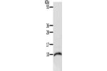 Gel: 10+15%SDS-PAGE, Lysate: 40 
