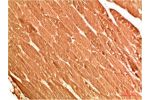 Immunohistochemical analysis of paraffin-embedded Human Skeletal Muscle Tissue using ATG13 Rabbit pAb diluted at 1:200