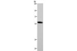 Gel: 6%SDS-PAGE, Lysate: 40 