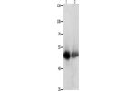 Gel: 10%SDS-PAGE, Lysate: 60 