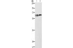 Gel: 10%SDS-PAGE, Lysate: 40 