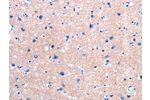 The image on the left is immunohistochemistry of paraffin-embedded Human brain tissue using CSB-PA568435(FPR2 Antibody) at dilution 1/25, on the right is treated with synthetic peptide. (Original magnification: 
