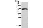 Gel: 8%SDS-PAGE, Lysate: 40 