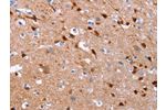 The image on the left is immunohistochemistry of paraffin-embedded Human brain tissue using CSB-PA569512(GCGR Antibody) at dilution 1/25, on the right is treated with synthetic peptide. (Original magnification: 