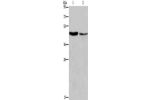 Gel: 10%SDS-PAGE, Lysate: 40 