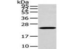 Gel: 12%SDS-PAGE,Lysate: 40 