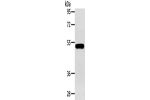 Gel: 8%SDS-PAGE, Lysate: 40 