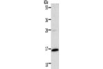 Gel: 12%SDS-PAGE, Lysate: 40 