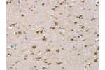 The image on the left is immunohistochemistry of paraffin-embedded Human brain tissue using CSB-PA575237(CSPG4 Antibody) at dilution 1/25, on the right is treated with synthetic peptide. (Original magnification: 