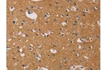 The image on the left is immunohistochemistry of paraffin-embedded Human brain tissue using CSB-PA576542(CD22 Antibody) at dilution 1/50, on the right is treated with fusion protein. (Original magnification: 