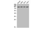Western blot analysis of HepG2 K562 Hela Colo using ADAMTS-2 antibody.. Secondary antibody  was diluted at 1:20000