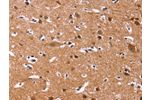 The image on the left is immunohistochemistry of paraffin-embedded Human brain tissue using CSB-PA576885(CHRM1 Antibody) at dilution 1/20, on the right is treated with fusion protein. (Original magnification: 