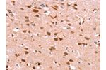 The image on the left is immunohistochemistry of paraffin-embedded Human brain tissue using CSB-PA576969(GH1 Antibody) at dilution 1/40, on the right is treated with synthetic peptide. (Original magnification: 