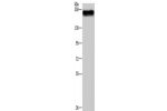 Gel: 8%SDS-PAGE, Lysate: 40 
