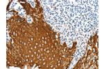 The image on the left is immunohistochemistry of paraffin-embedded Human tonsil tissue using CSB-PA579076(ANXA9 Antibody) at dilution 1/20, on the right is treated with fusion protein. (Original magnification: 
