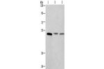 Gel: 10%SDS-PAGE, Lysate: 40 