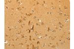 The image on the left is immunohistochemistry of paraffin-embedded Human brain tissue using CSB-PA589025(CFHR1 Antibody) at dilution 1/40, on the right is treated with fusion protein. (Original magnification: 