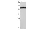 Gel: 10%SDS-PAGE, Lysate: 40 