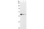 Gel: 10%SDS-PAGE, Lysate: 40 