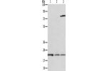 Gel: 12+15%SDS-PAGE, Lysate: 40 
