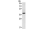 Gel: 8%SDS-PAGE, Lysate: 40 
