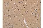 The image is immunohistochemistry of paraffin-embedded Human brain tissue using CSB-PA595538(CENPN Antibody) at dilution 1/70. (Original magnification: 