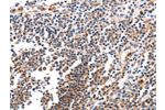 The image on the left is immunohistochemistry of paraffin-embedded Human tonsil tissue using CSB-PA597282(BCL2L15 Antibody) at dilution 1/50, on the right is treated with fusion protein. (Original magnification: 