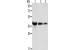 Gel: 10%SDS-PAGE, Lysate: 40 