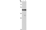Gel: 10%SDS-PAGE, Lysate: 40 