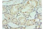 Immunohistochemistry of paraffin-embedded human kidney tissue using CSB-PA600078LA01HU at dilution of 1:100