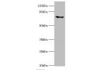 Western blot<br />
All lanes:Peroxisomal bifunctional enzyme antibody at 2ug/ml+mouse kidney tissue<br />
Secondary<br />
Goat polyclonal to rabbit at 1/10000 dilution<br />
Predicted band size: 80,70 kDa<br />
Observed band size: 79 kDa<br />
