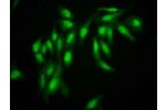 Immunofluorescence staining of Hela cells with CSB-PA600257LA01HU at 1:166,counter-stained with DAPI. The cells were fixed in 4% formaldehyde, permeabilized using 0.2% Triton X-100 and blocked in 10% normal Goat Serum. The cells were then incubated with t