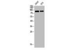 Western blot analysis of 293T 3T3 lysis using FGFR4 antibody. Antibody was diluted at 1:500. Secondary antibody  was diluted at 1:20000