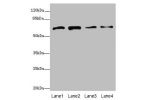 Western blot<br />
All lanes: