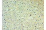 Immunohistochemistry of paraffin-embedded human liver using CSB-PA606010DSR2HU at dilution 1:100