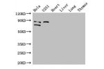 Western Blot<br />
Positive WB detected in:Hela whole cell lysate,U251 whole cell lysate,Mouse heart tissue,Mouse liver tissue,Mouse lung tissue,Mouse thymus tissue<br />
All lanes: FCHO2 antibody at 3ug/ml<br />
Secondary<br />
Goat polyclonal to rabbit 