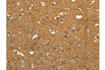 The image on the left is immunohistochemistry of paraffin-embedded Human brain tissue using CSB-PA610964(AKAP12 Antibody) at dilution 1/40, on the right is treated with synthetic peptide. (Original magnification: 
