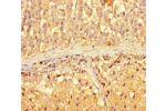 Immunohistochemistry of paraffin-embedded human adrenal gland tissue using CSB-PA612678LA01HU at dilution of 1:100