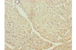 Immunohistochemistry of paraffin-embedded human heart tissue using CSB-PA613263DSR1HU at dilution of 1:100