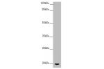 Western blot<br />
All lanes:CETN1 antibody at 2.7 ug/ml+ Mouse gonadal tissue<br />
Secondary<br />
Goat polyclonal to rabbit IgG at 1/10000 dilution<br />
Predicted band size: 20 kDa<br />
Observed band size: 20 kDa<br />