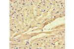 Immunohistochemistry of paraffin-embedded human heart tissue using CSB-PA613266LA01HU at dilution of 1:100