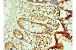 Immunohistochemistry of paraffin-embedded human small intestine using CSB-PA613267ESR1HU at dilution 1:100