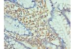 Immunohistochemistry of paraffin-embedded human small intestine using CSB-PA613427ESR1HU at dilution 1:100