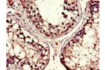 Immunohistochemistry of paraffin-embedded human testis tissue using CSB-PA613491LA01HU at dilution of 1:100
